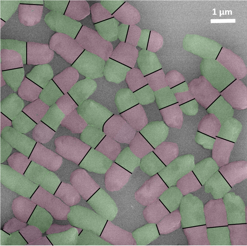 SEM image shows colored E. coli in an healthy state