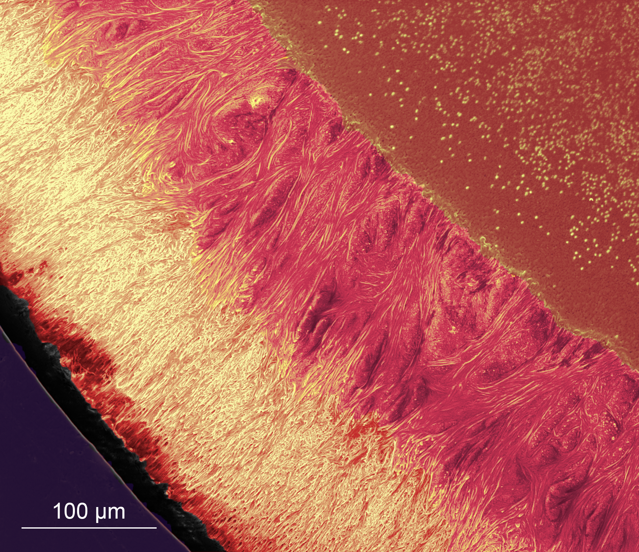 scanning electron microscopy image of a fish tooth cross-section