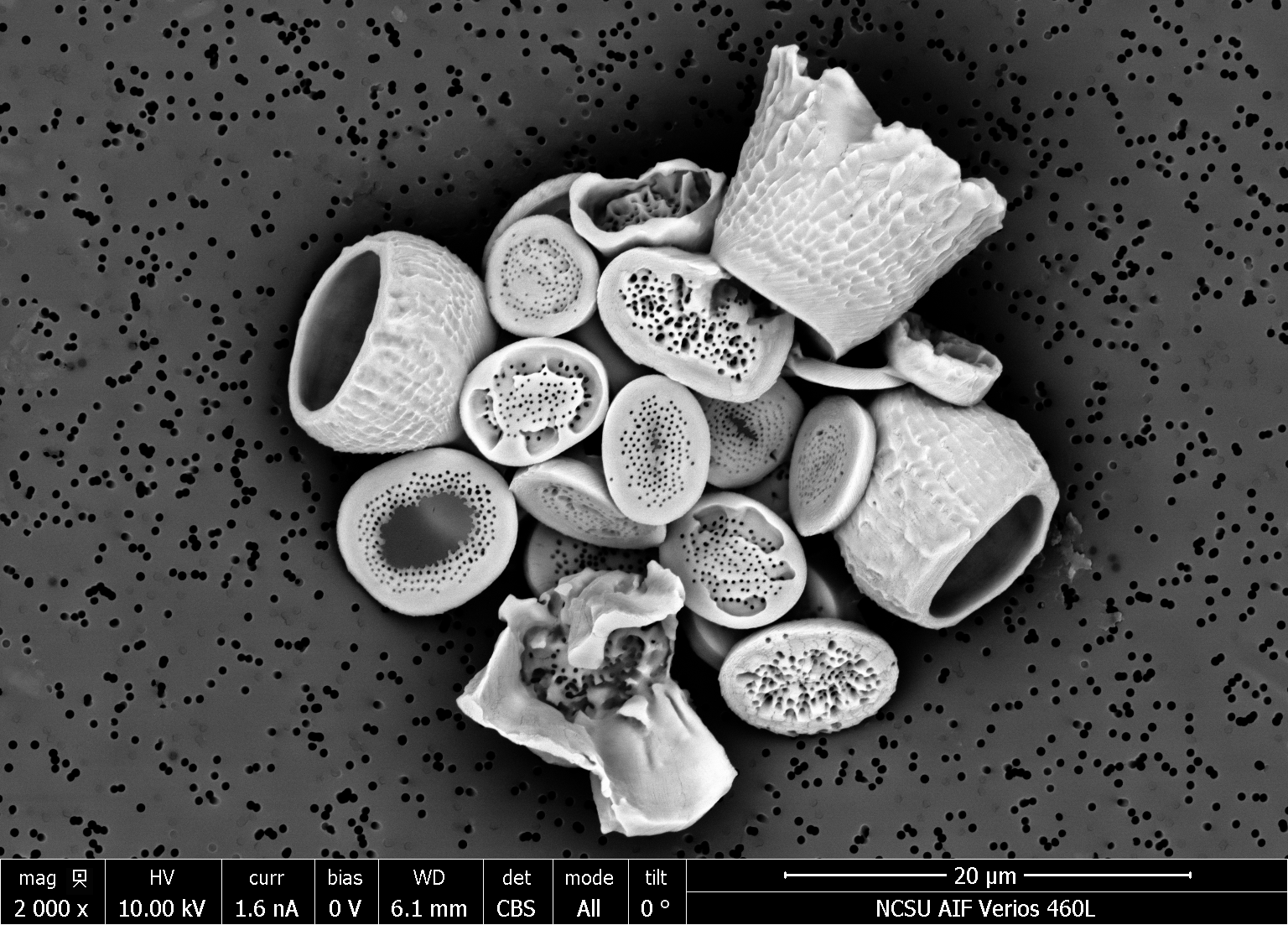 malformed morphology of coccolithophore (single-celled algae) S. apsteinii