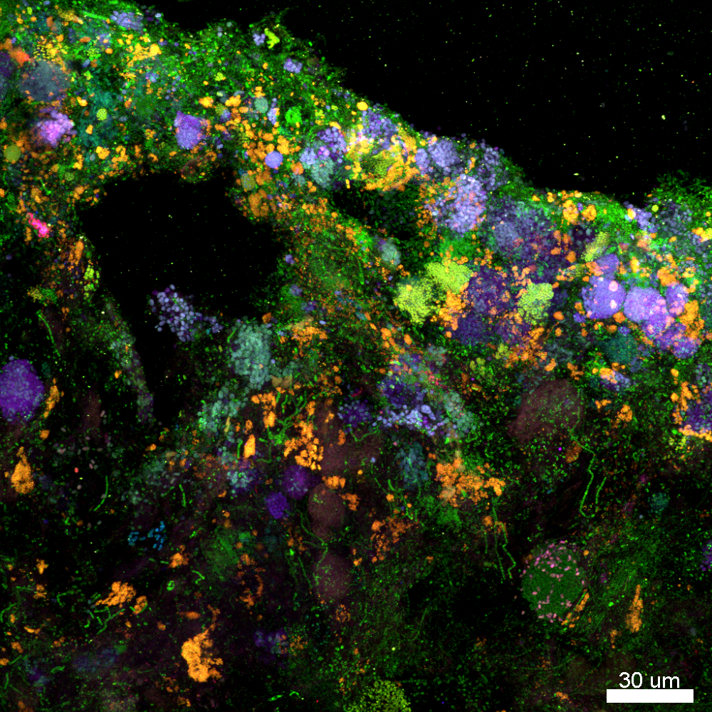 Lighting up the hidden life of wastewater bacteria