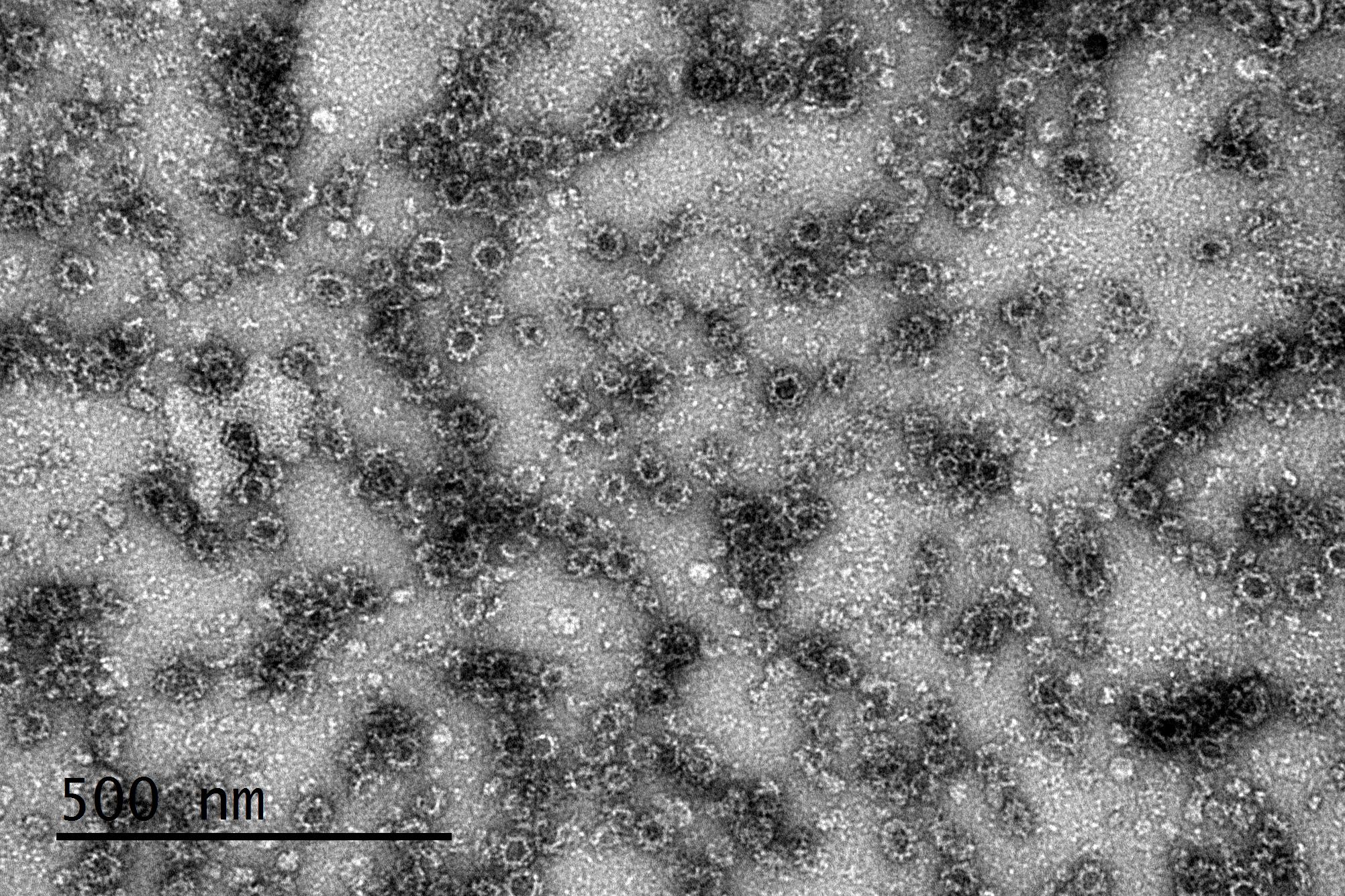 Human Norovirus GII.4 Viral Like particles