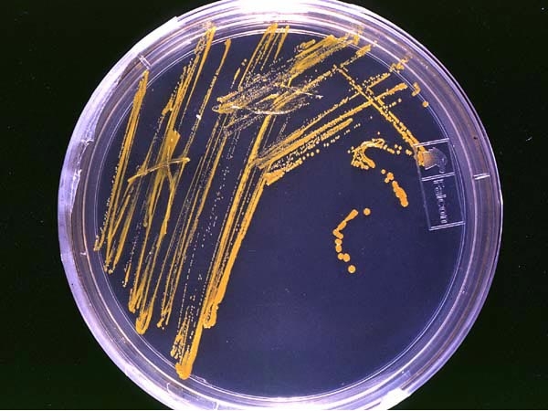 Agar plate with bacterial colonies from Wikipedia Public Domain, https://commons.wikimedia.org/w/index.php?curid=87008